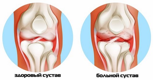 Новость Заряд